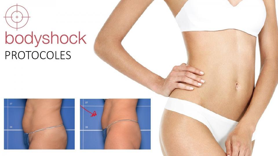 Trattamento BODYSHOCK cos'è?